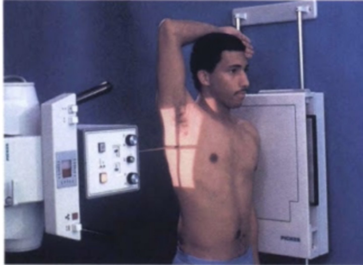 <p>central ray, perpendicular to the sagittal plane and parallel to the coronal plane, passes from one side of the body to the other</p><p>travels transversely along the coronal plane</p><p>specify side of the body closest to the IR</p><p>SIDE VIEW</p>