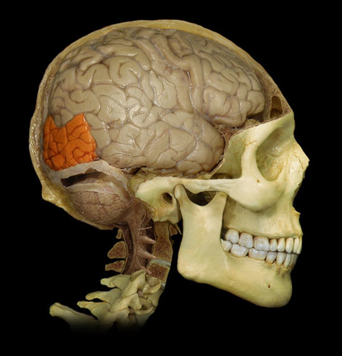 <p>Processes beginning of vision signals, visual cortex interprets messages from eyes detecting lines, shapes, and colors.</p>