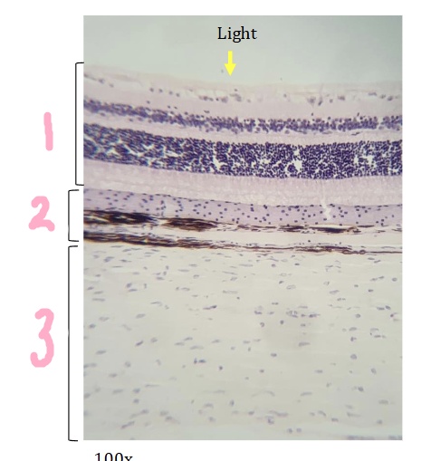 <p>What is #2 pointing to?</p>