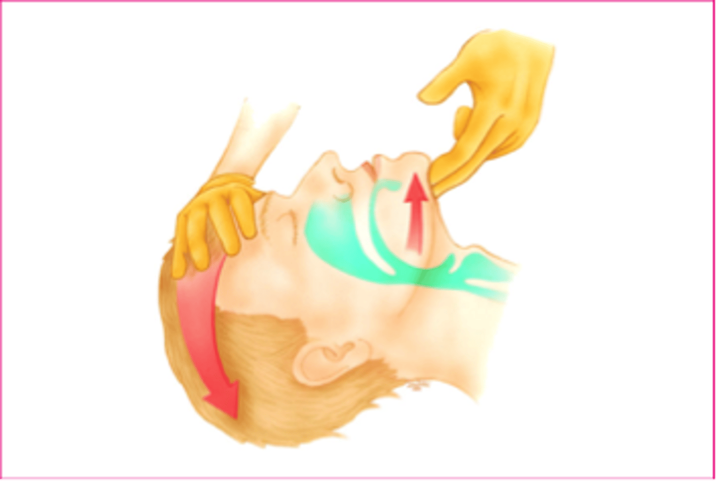 <p>no spinal injury</p>