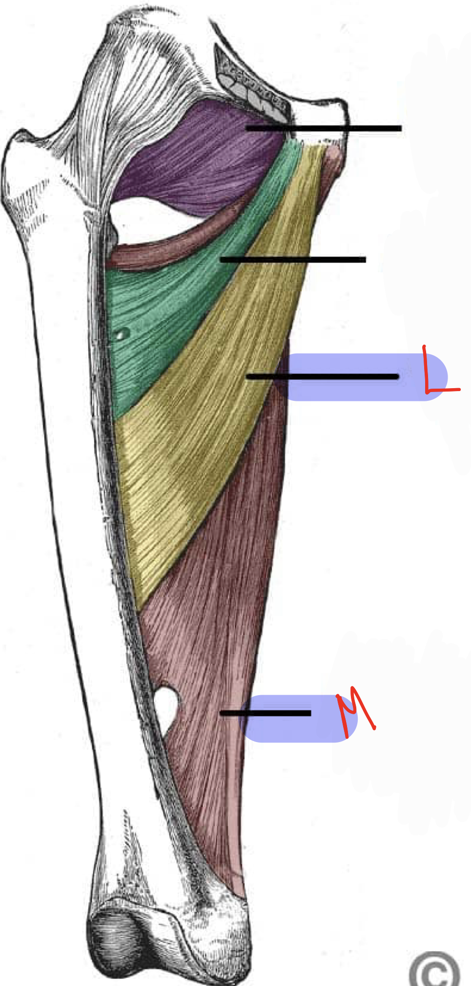 <p>ADduction of hip</p>