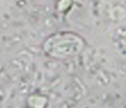 <p>ingestion of cysts</p>