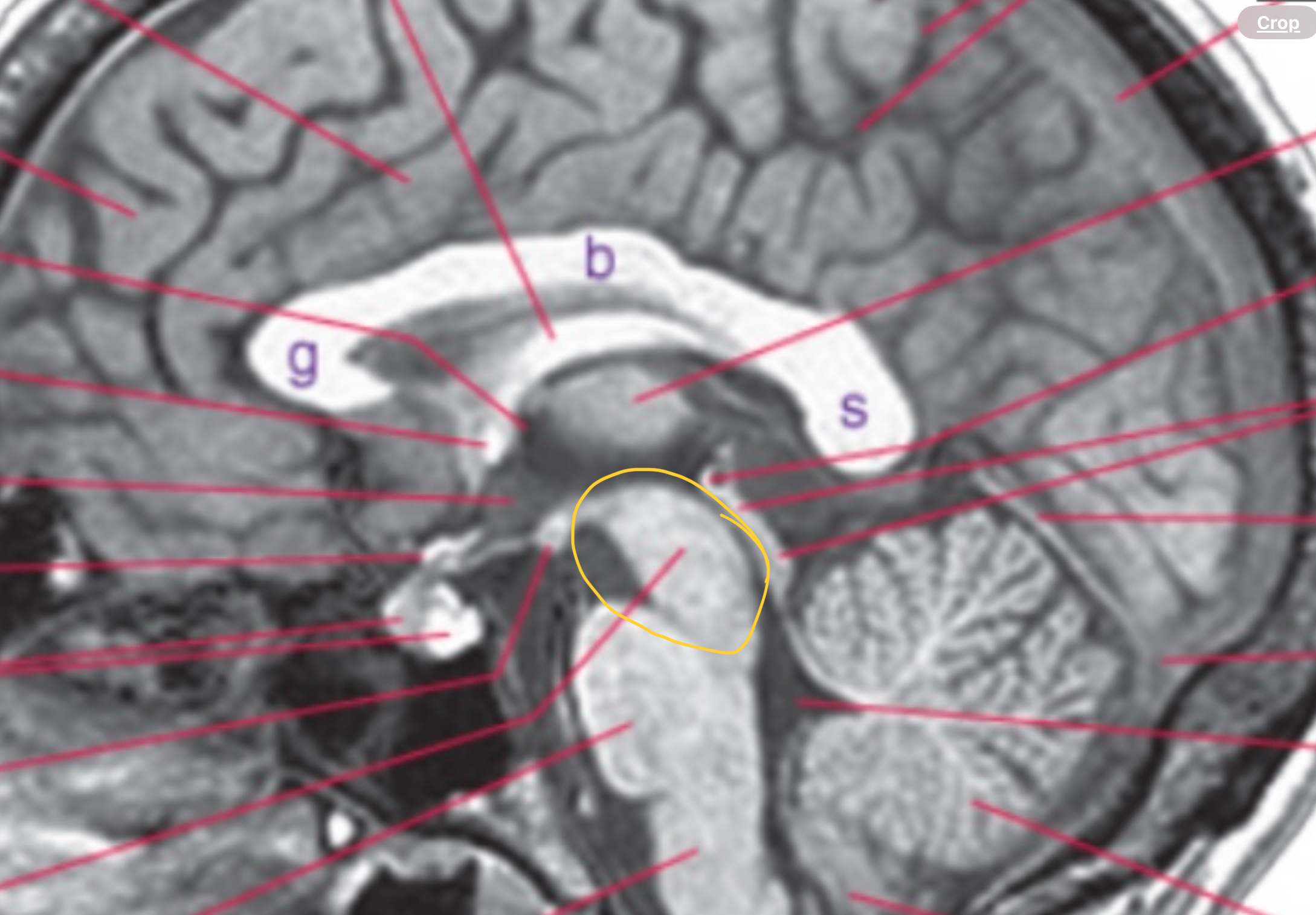 <p>Midbrain</p>