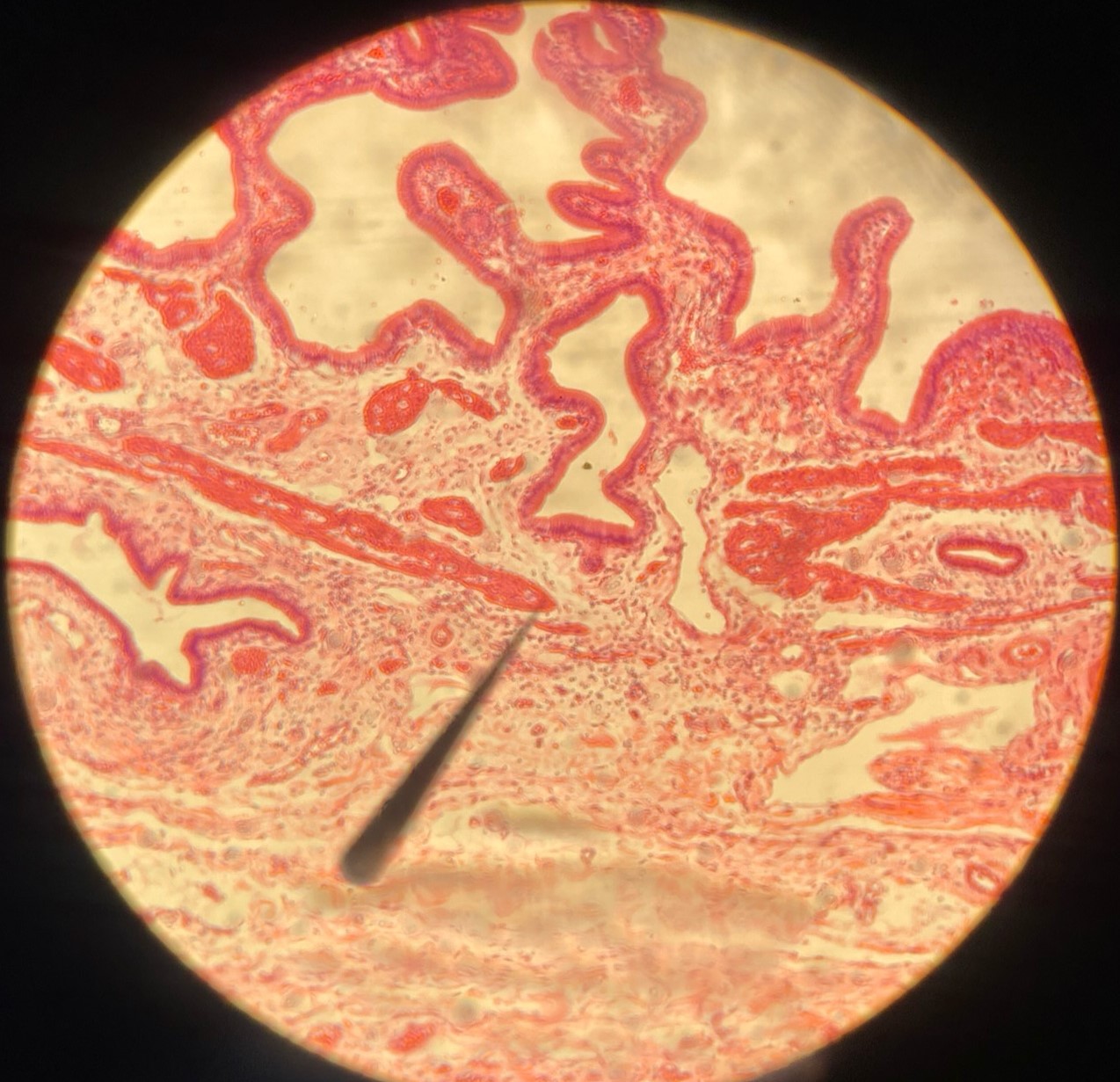 <p>simple columnar epithelium</p>