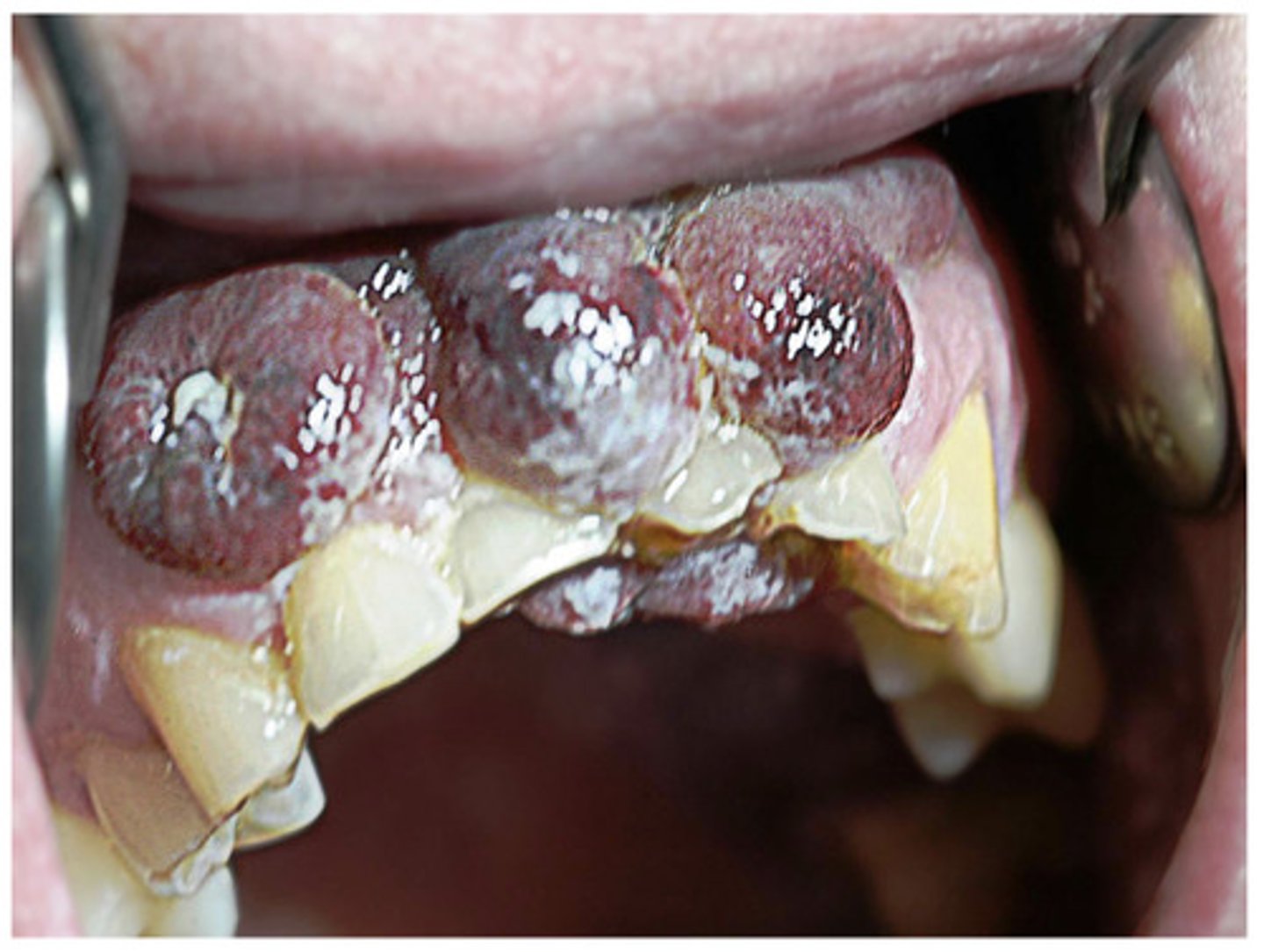 <p>What is this>?</p>