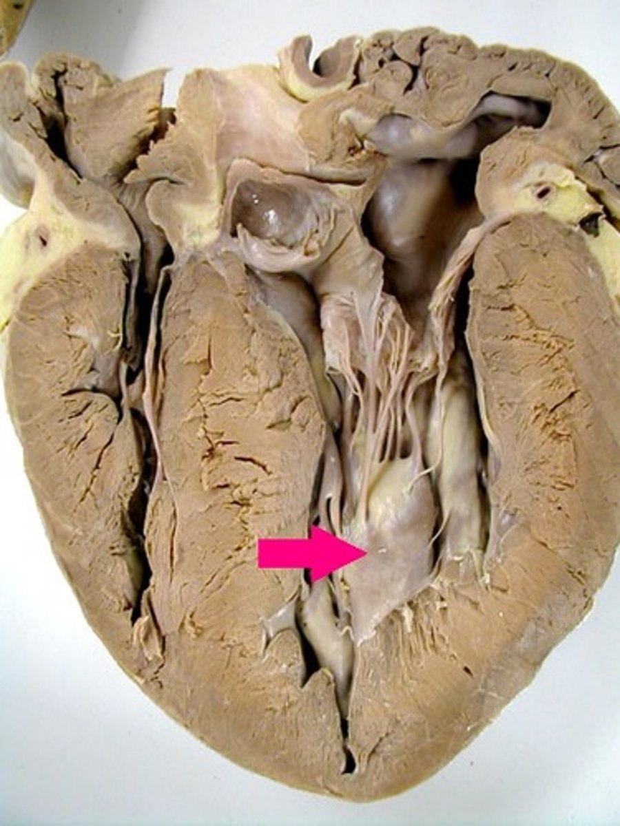 <p>Identify the muscle.</p>