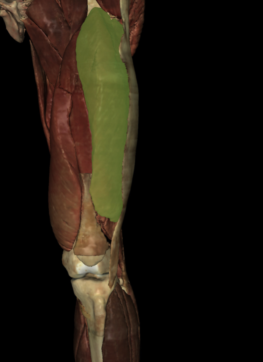 <p>Identify the Structure</p>