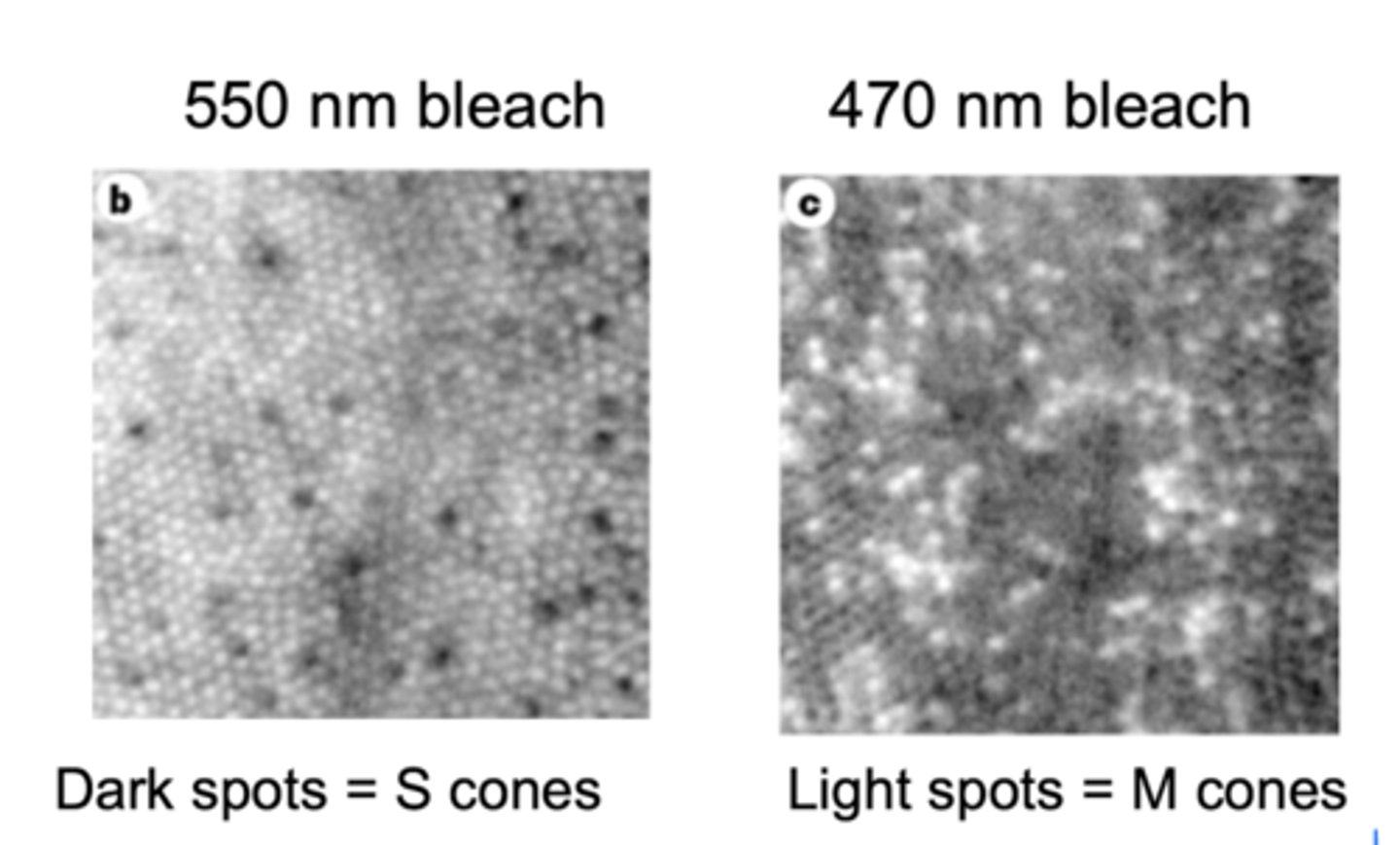 <p>becomes transparent to light</p><p>lighter - bleached photoreceptors</p>