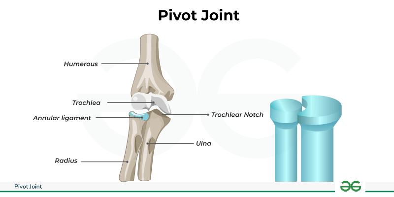 <p>What joint type is this?</p>