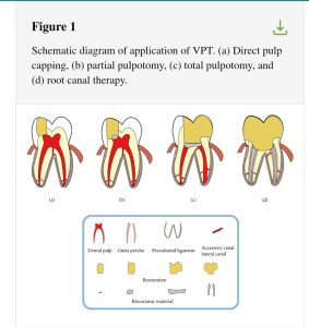<p>It usually requires extraction, although it can sometimes remain in the alveolus with few problems.</p><p>Complete pulpectomy, vital pulpotomy</p>