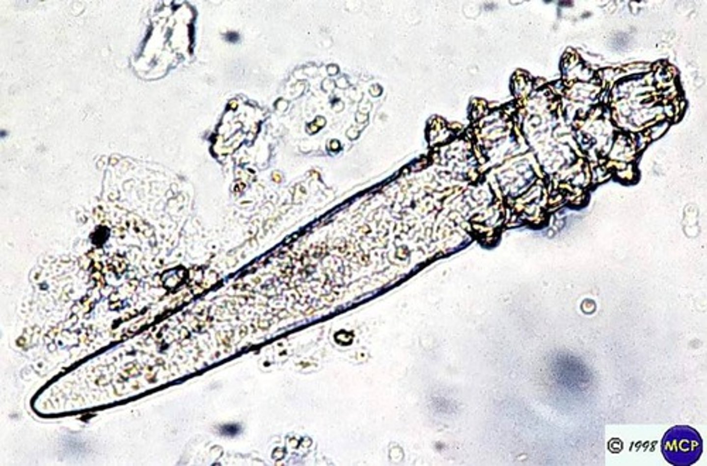 <p>notice the cigar shaped appearance</p>