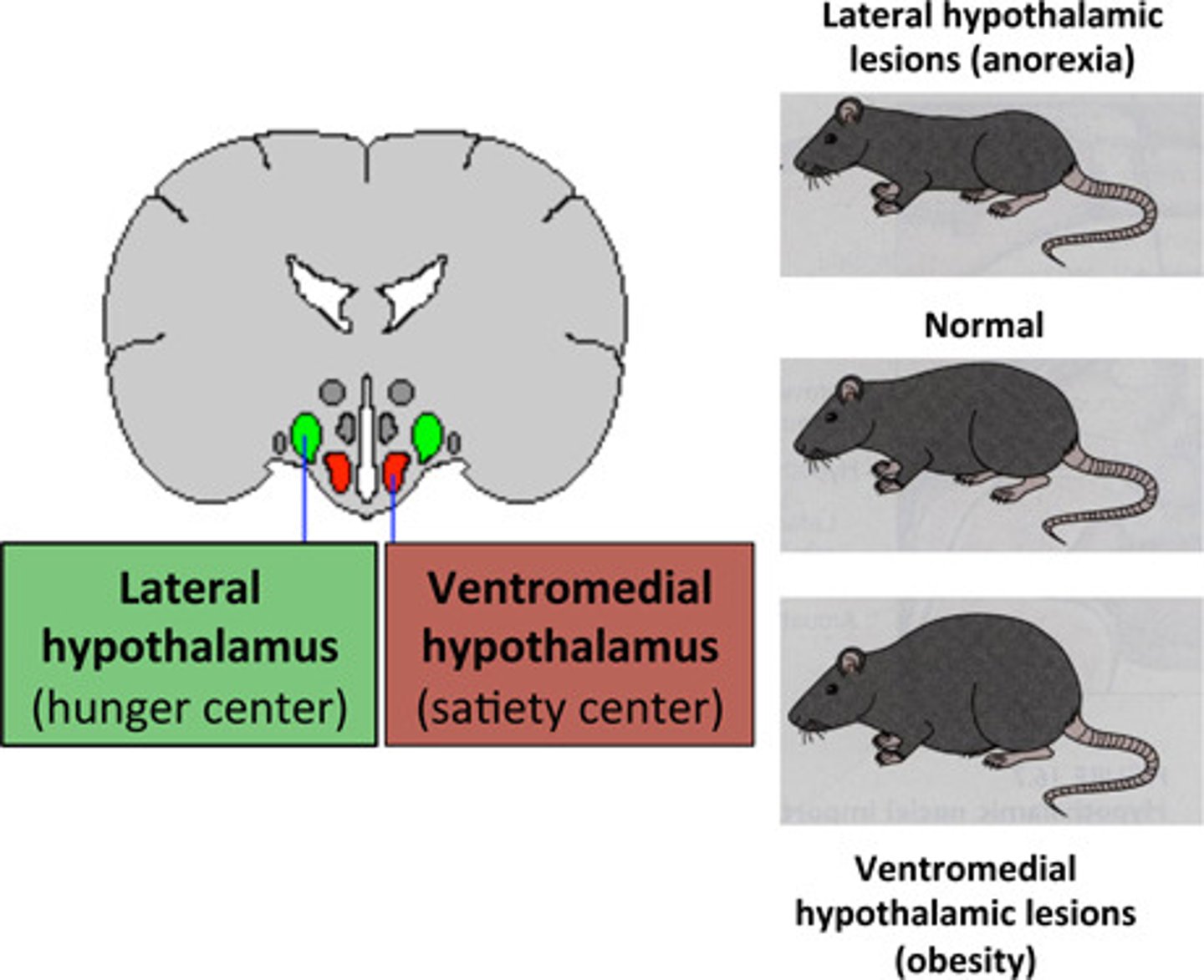 <p>(A) Lateral Hypothalamus, Ventromedial Hypothalamus</p><p>When you are hungry, your Lateral Hypothalamus will signal to you that you are hungry. Once you've eaten enough and are full, your Ventromedial Hypothalamus will signal to you to stop eating.</p>