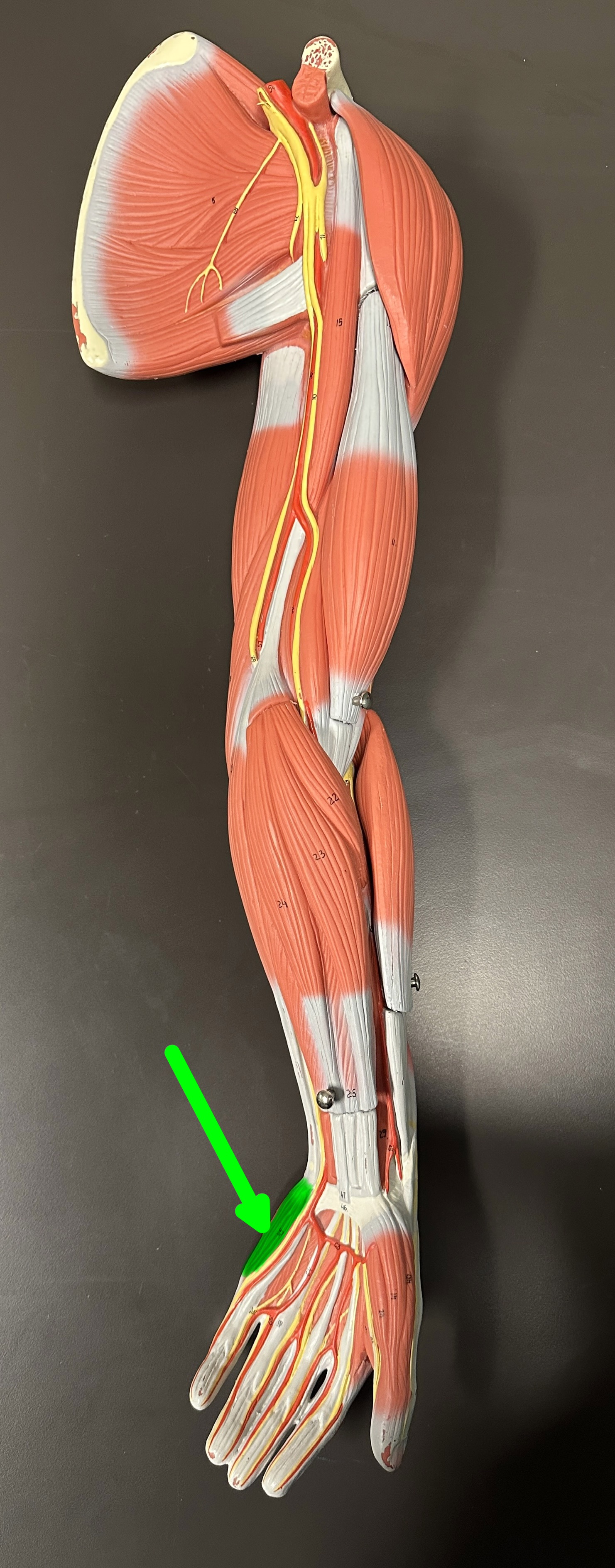<p>What is the highlighted structure</p>