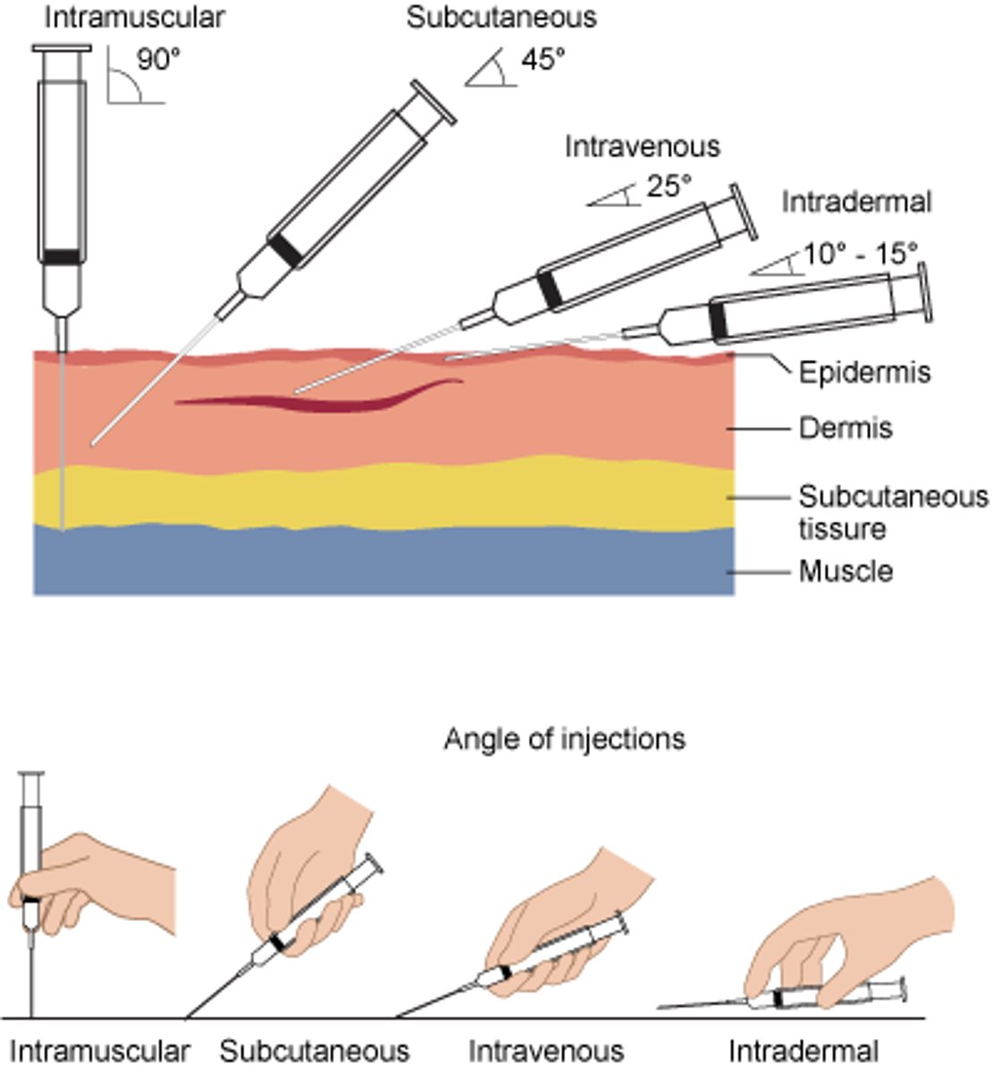 <p>Intradermal (ID)</p><p>Subcutaneous (SQ)</p><p>Intramuscular (IM)</p><p>Intravenous (IV)</p>