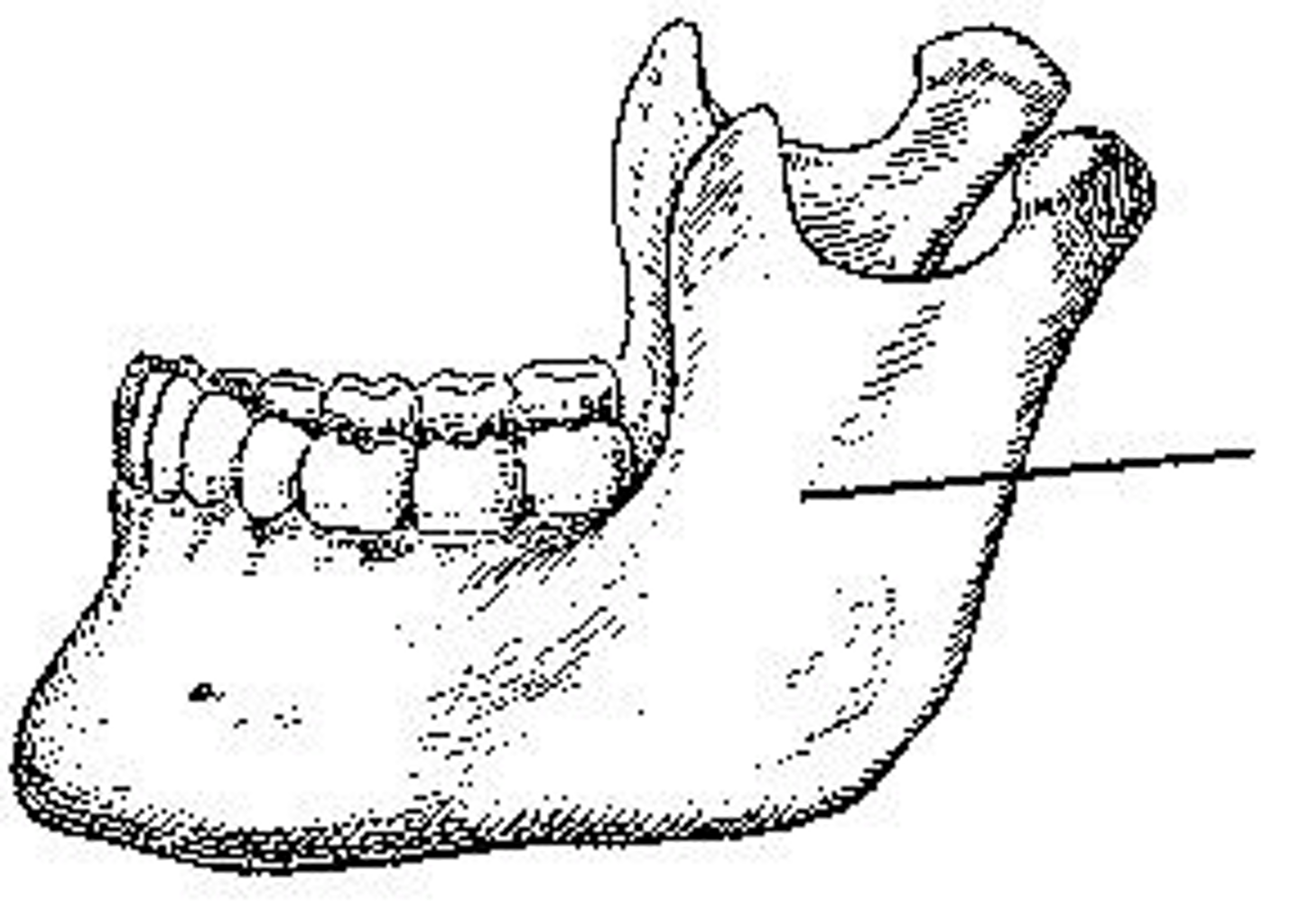 <p>What portion of the mandible is identified?</p>