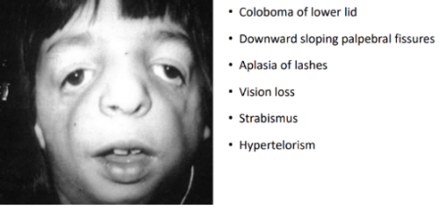 <p>a craniofacial syndrome caused by an autosomal dominant mutation of the TCOF1 gene resulting in hypoplasia of the zygomatic, maxillary, and mandibular bones. Is also commonly associated with underdevelopment of the ear and hearing, cleft palate, and airway problems. May or may not have impaired intelligence.</p>