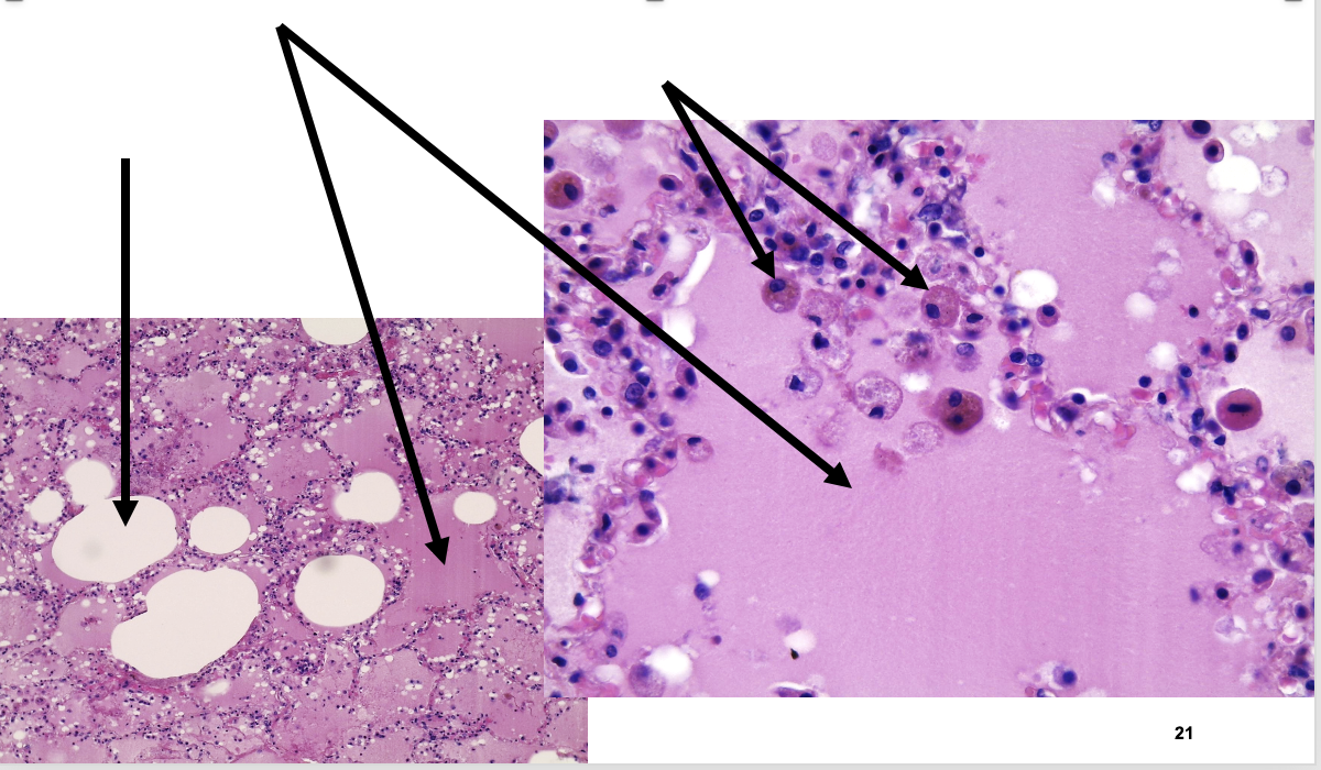 <p>benoem de pijlen van links naar rechts+ waarover het gaat</p>