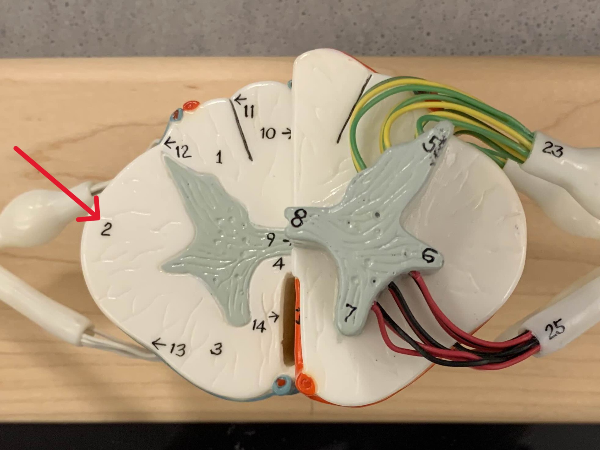 <p>Which white column of the spinal cord is:</p><ul><li><p>Between anterior and posterior columns</p></li></ul><p></p>