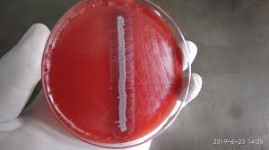 <p>Requires Chocolate agar: Require X (hemin) and V (NAD) factor</p><p>satellitism</p><p>capsule</p><p>catalse positive</p><p>reduce nitrates</p>