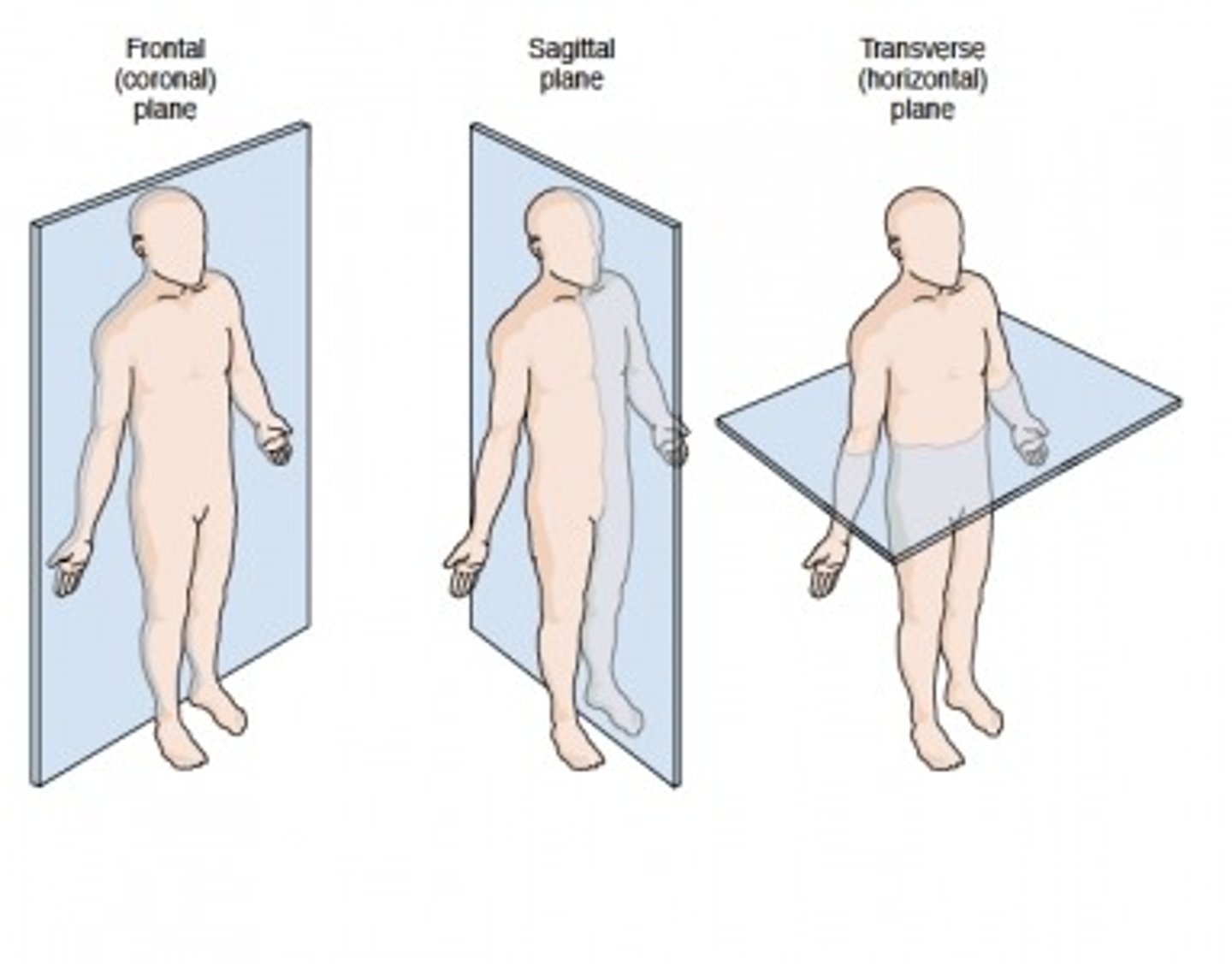 <p>A. CORRECT. The transverse plane divides the body into upper and lower portions.</p><p>B. The coronal plane divides the body into equal front and back portions.</p><p>C. The sagittal plane divides the body into asymmetrical left and right sides.</p><p>D. The midsagittal plane divides the body into bilaterally symmetrical left and right sides.</p>
