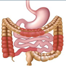 <p>what are the characteristics of crohn’s disease?</p>