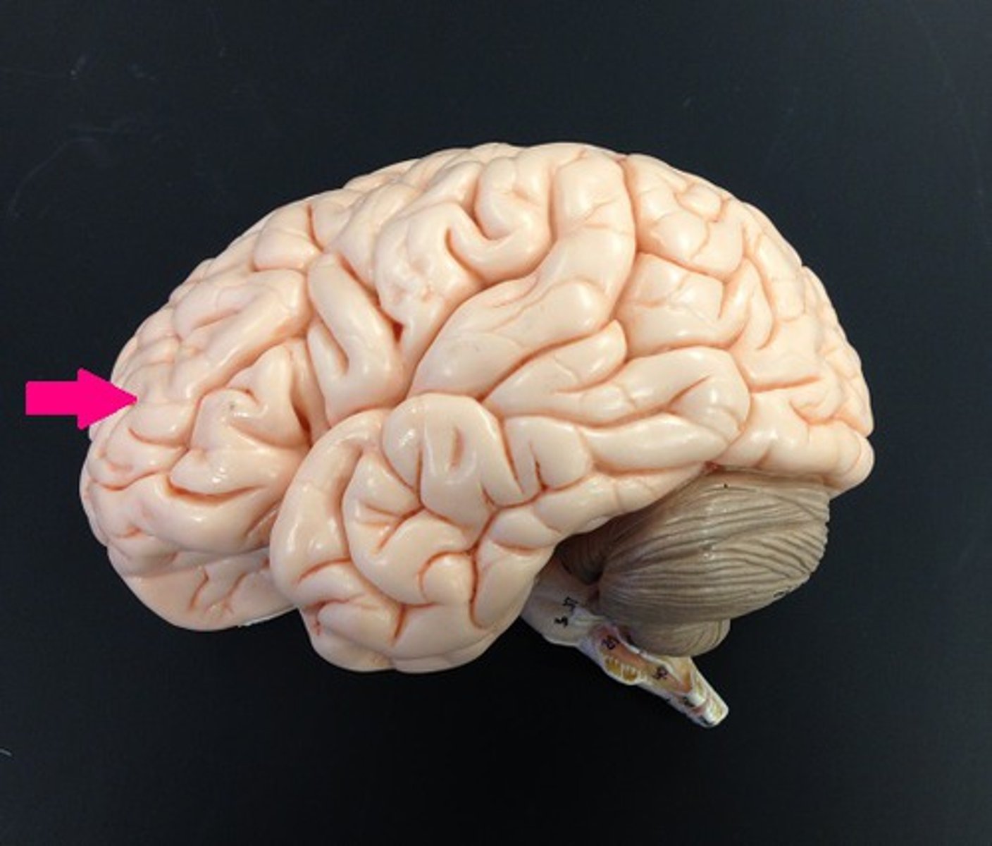 <p>Identify the lobe.</p>