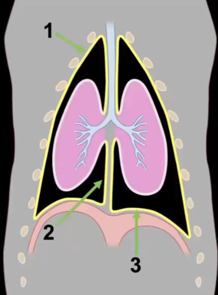 <p>What type of pleura is 3?</p>