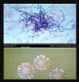 <p>ID:<br>* White, opaque and resemble “molar tooth”</p><ul><li><p>Gram positive, branching filamentous rods</p></li></ul><p></p>