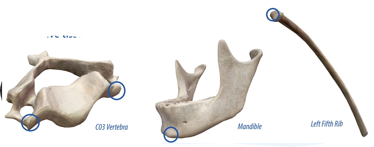 <p>A small round projection that allows connective tissues to connect to the bone.</p>