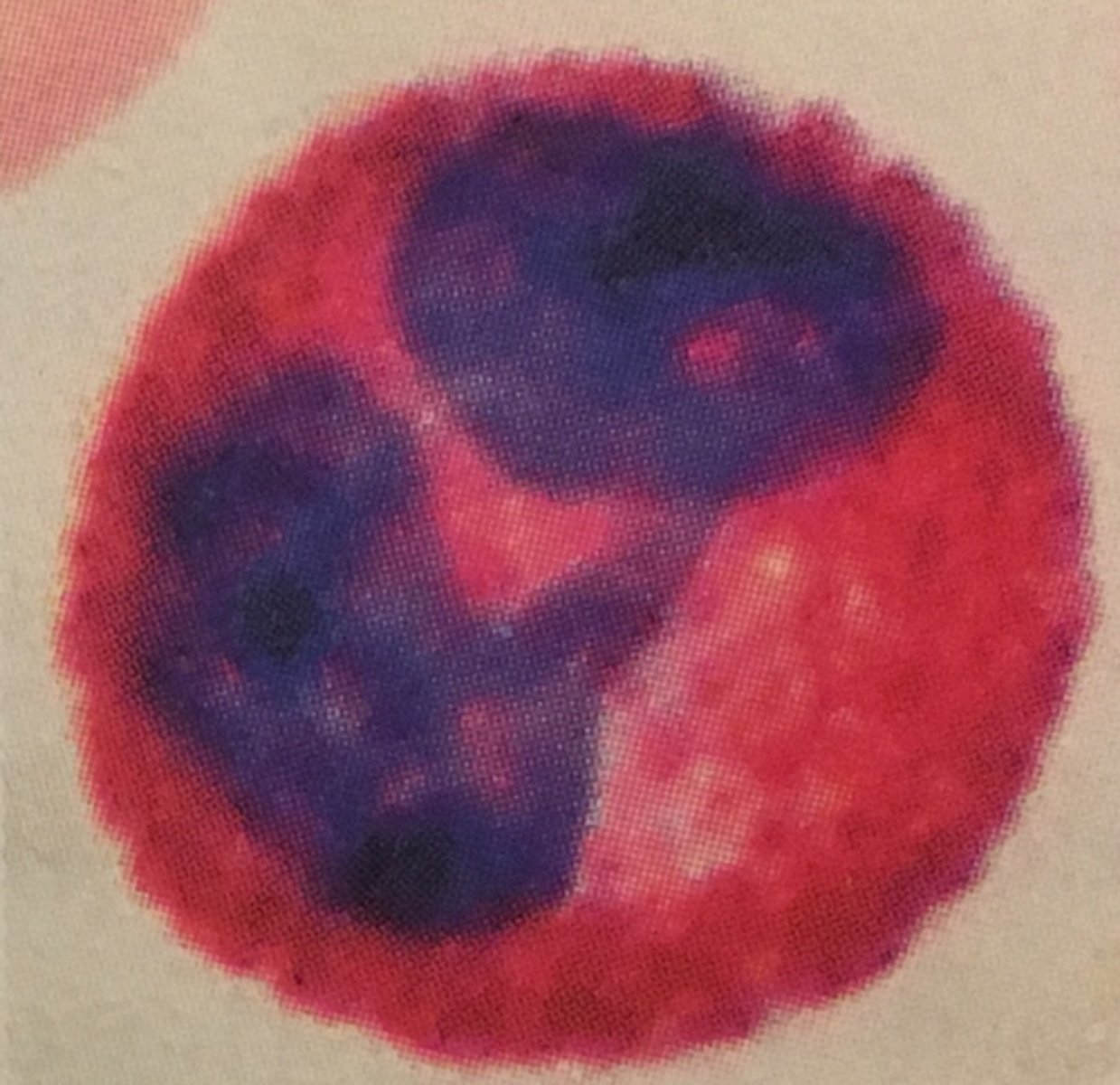 <p>Is this leukocyte granulated or agranulated?</p>