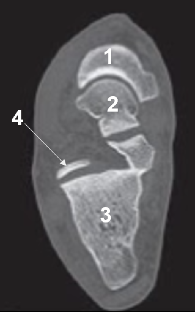 <p>4</p>