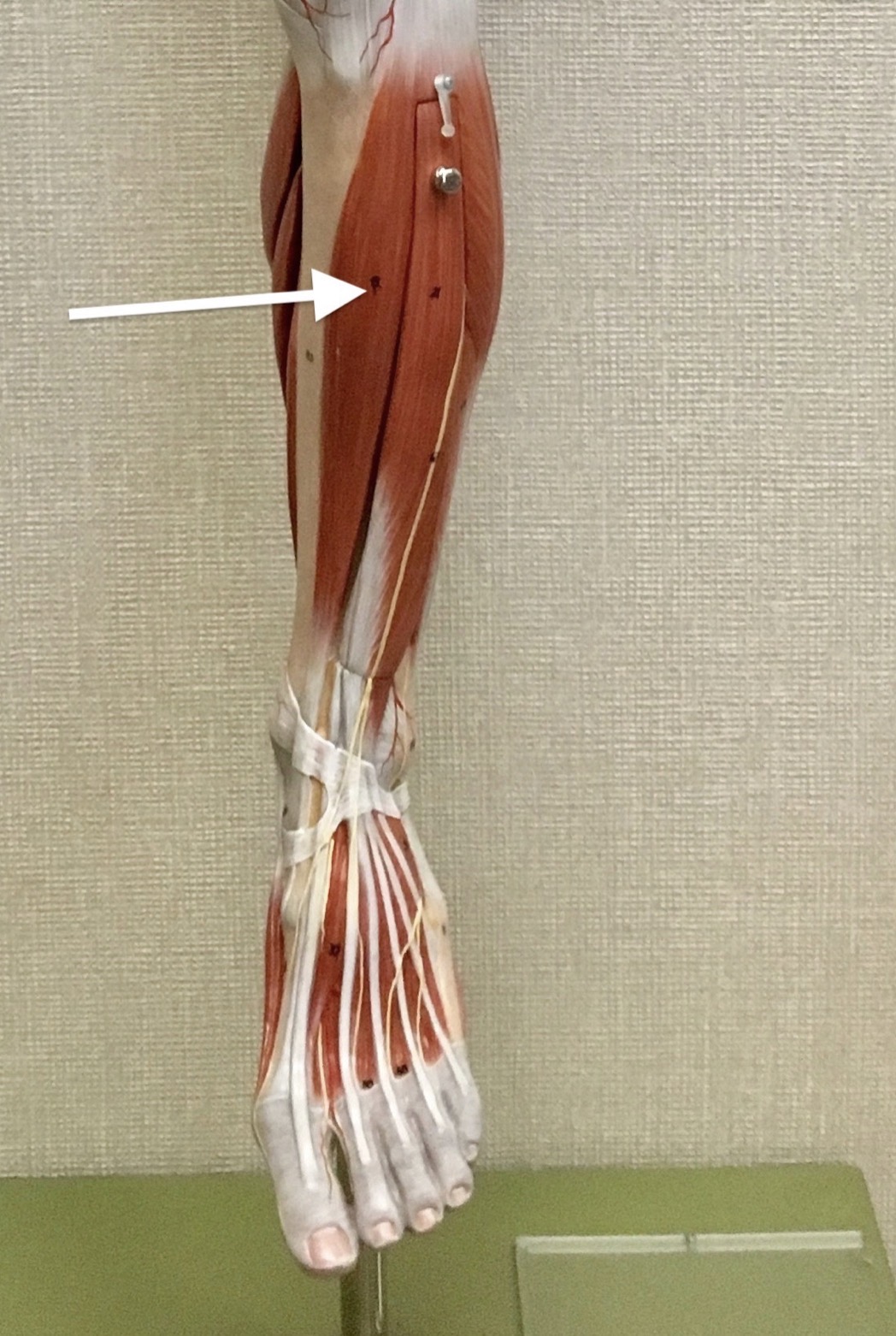 <p><span>Name the muscle labeled with the white arrow below AND name the insertion .</span></p>