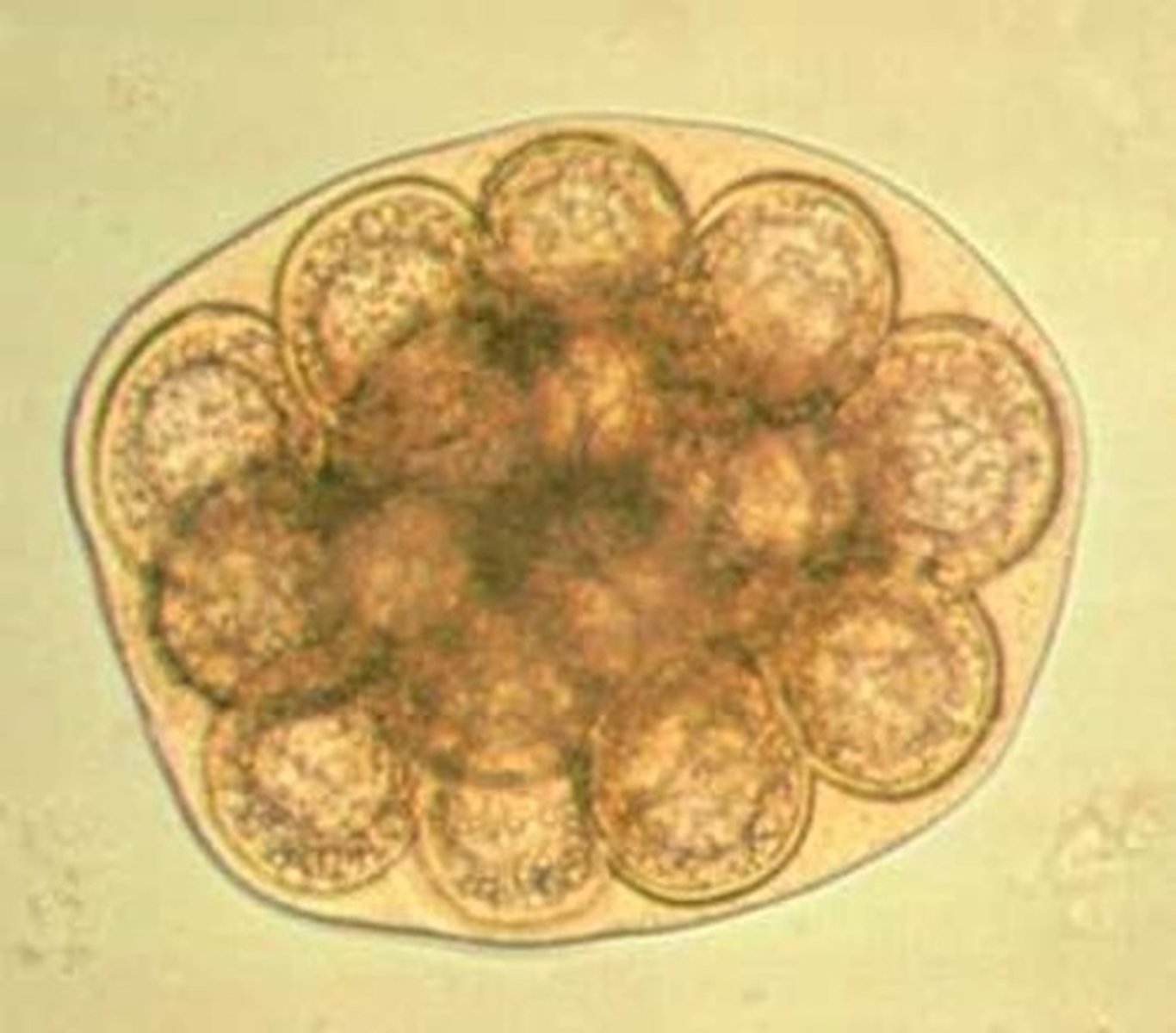 <p>This was found in the stool sample of a dog with no associated clinical signs. What is it?</p>