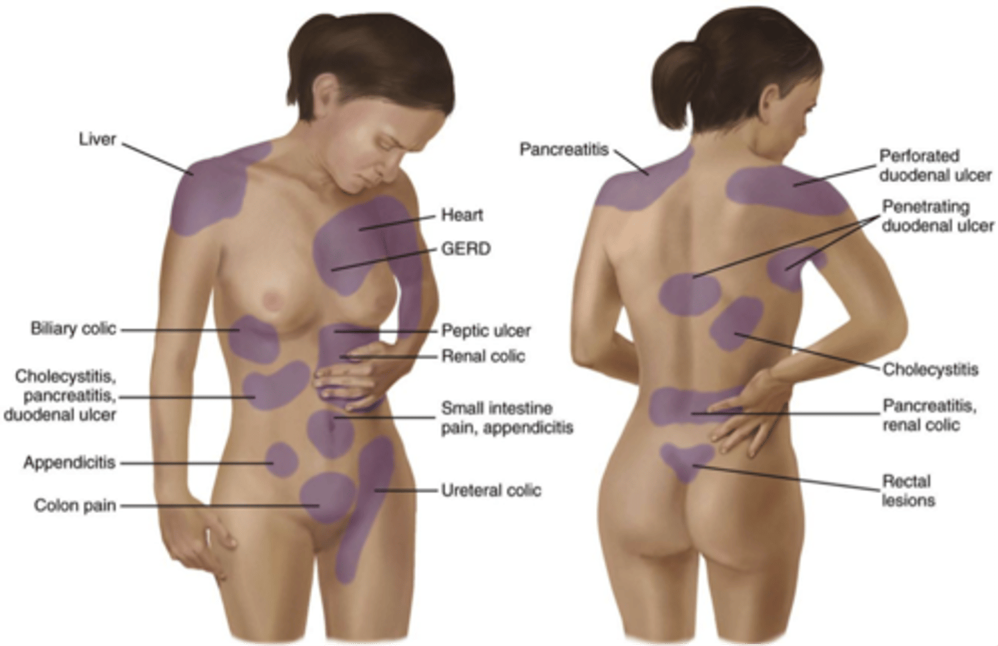 <p>đau ở nhiều bộ phận khác nhau trên cơ thể, khó chịu nhưng không quá dữ dội</p>