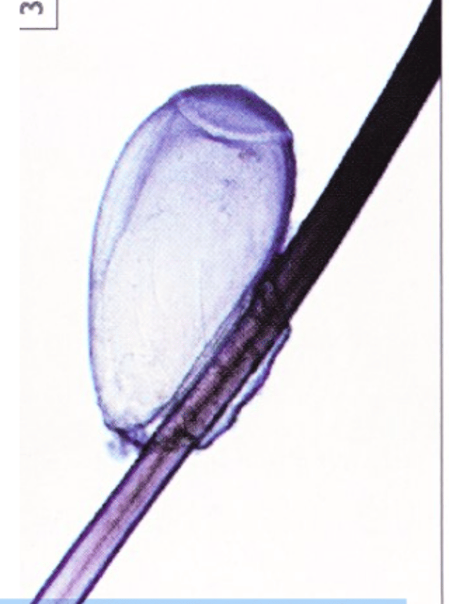 <p>Host specific;</p><p>All developmental stages are present on the host (unlike fleas and ticks);</p><p>Less common than in the past</p><p>More common during the cold season</p><p>Common in young animals and immunosuppressed or neglected /debilitated animals =&gt;massive populations can develop rapidly in these animals</p><p>Transmitted mainly by direct contact =&gt; infestations are common where animals are housed together;</p>