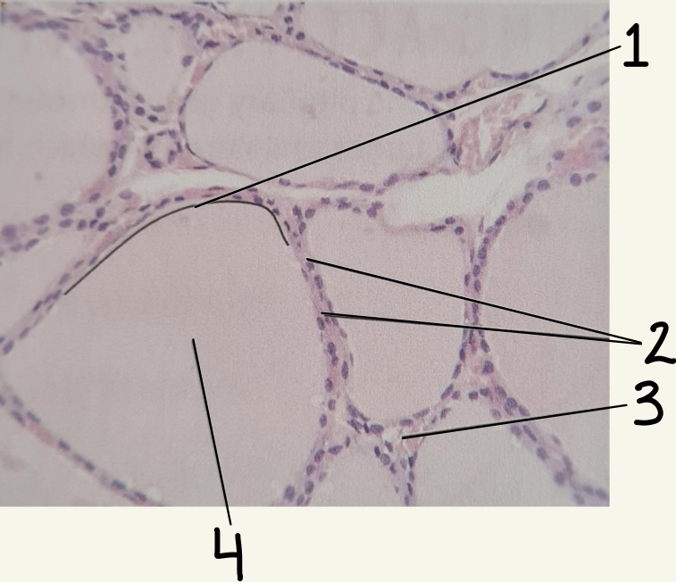 Thyroid gland slide