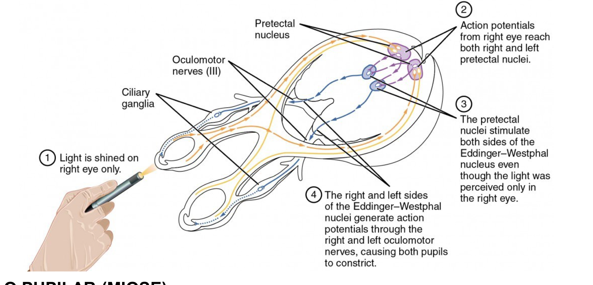 <p>Fibras núcleos pré-tectais → núcleos Edinger-Westphal → n. oculomotores (via parassimpática) → sinapse gânglio ciliar ipsilat. → contração p/ esfíncter pupila + acomodação cristalino p/ m. ciliar</p>