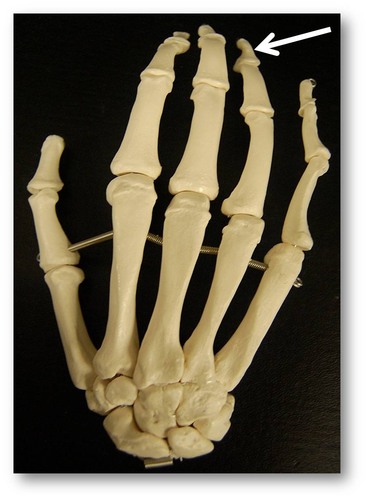 Name this specific bone.