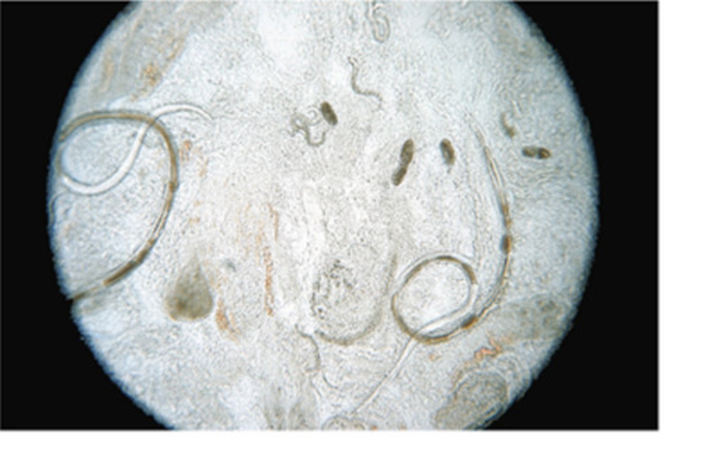 <p>This parthenogenetic nematode of dogs and cats is a zoonotic parasite. In cats and humans, the female produces larvated ova that are assed in the feces. However, in the dog, the ova hatch in the intestine and pass first-stage larvae in the feces. This parasite is</p>