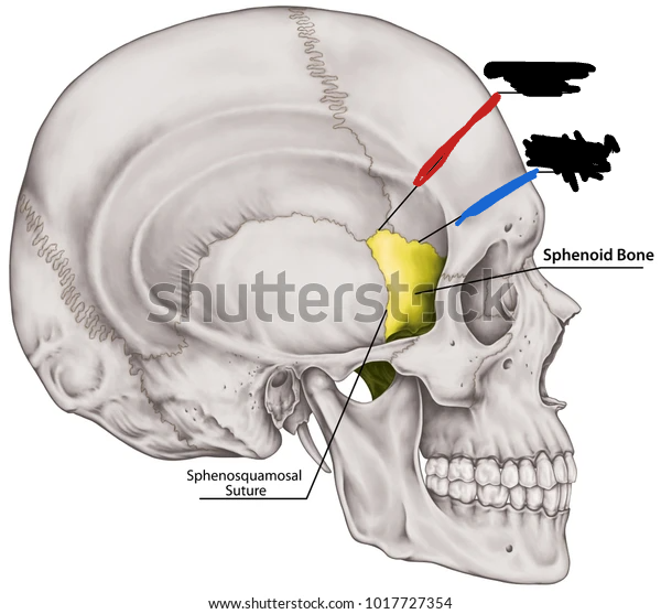 <p>what suture is the red line pointing to? (lateral view)</p>