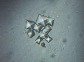<p>Name the crystal</p>