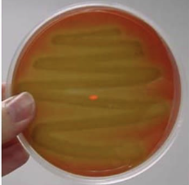 <p>Green, cloudy around the colony due to partial destruction of RBCs caused by hydrogen peroxide produced by bacteria; typically non-pathogenic but can be pathogenic</p>