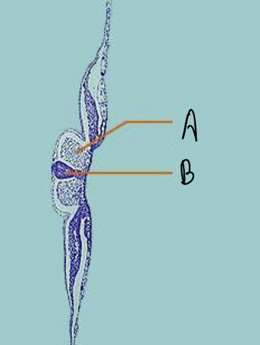 <p>B</p>