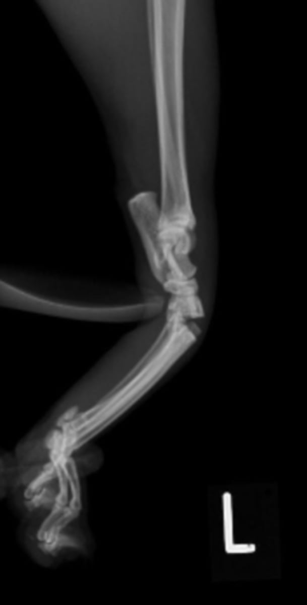 <p>point of pain in the center.</p>