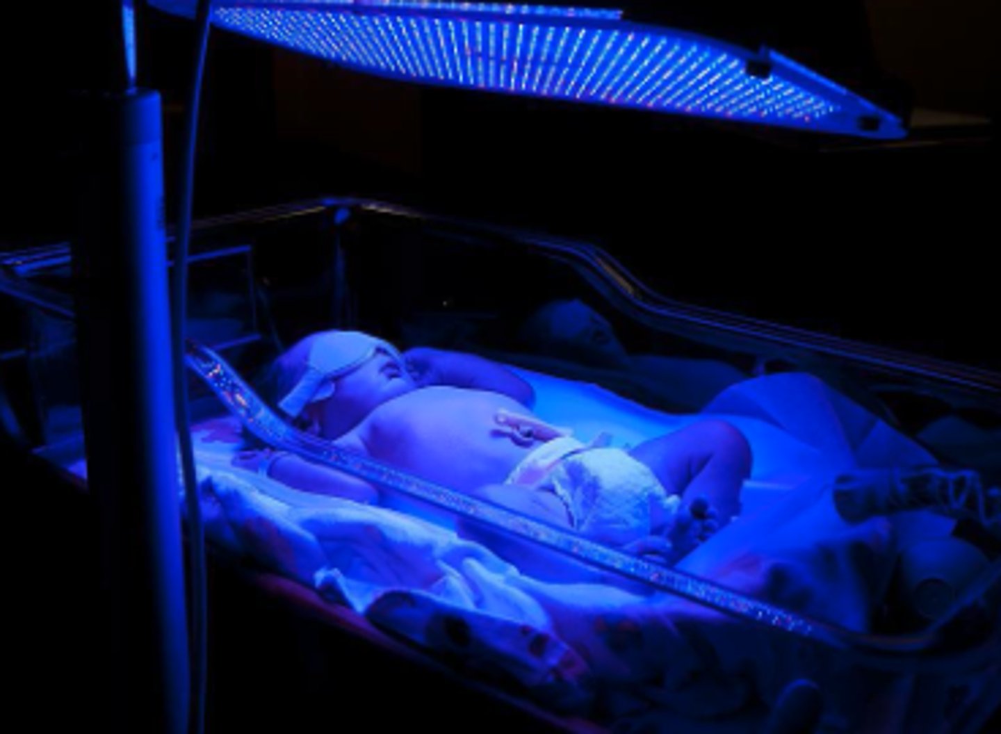 <p>A(n) ______ is a light therapy tool used to treat jaundice in newborns wherein the infant is placed under blue lights which convert bilirubin for proper excretion.</p>