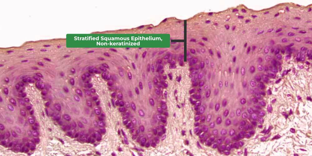 <p>No keratin and is found in more protective layers like the oral cavity, the pharynx (throat), the anus, and the vagina. Superficial cells survive because they're not as thick. </p>