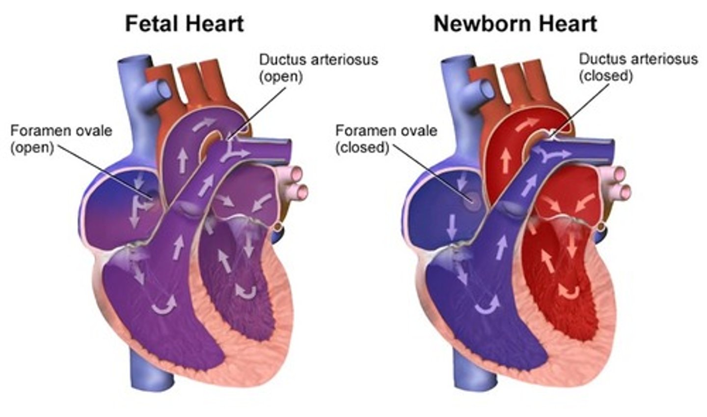 <p>pulmonary artery; ductus arteriosus</p>