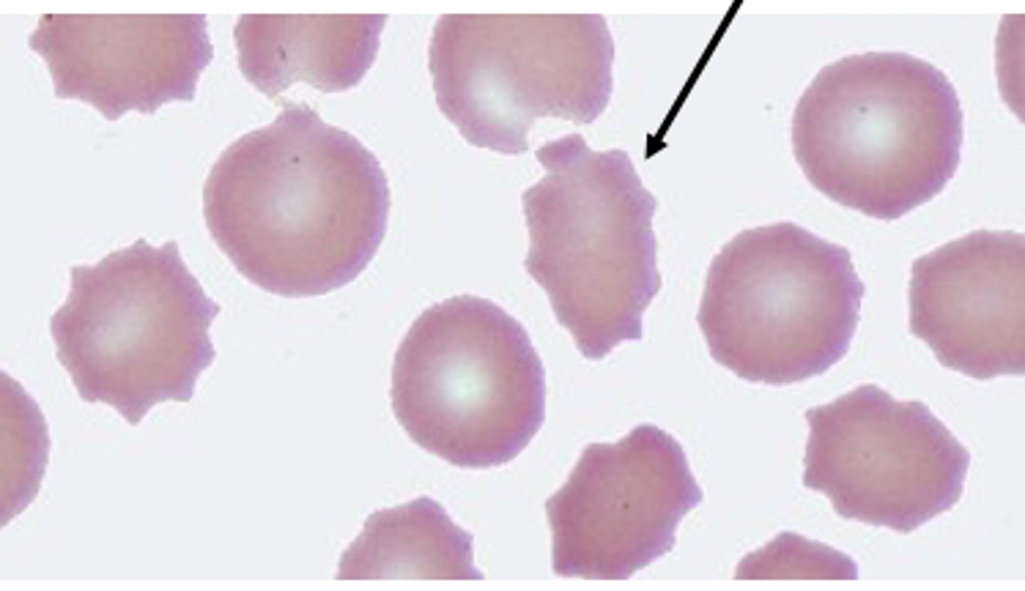<p>In what type of solution do RBCs become spiky? (aka: Crenation)</p>