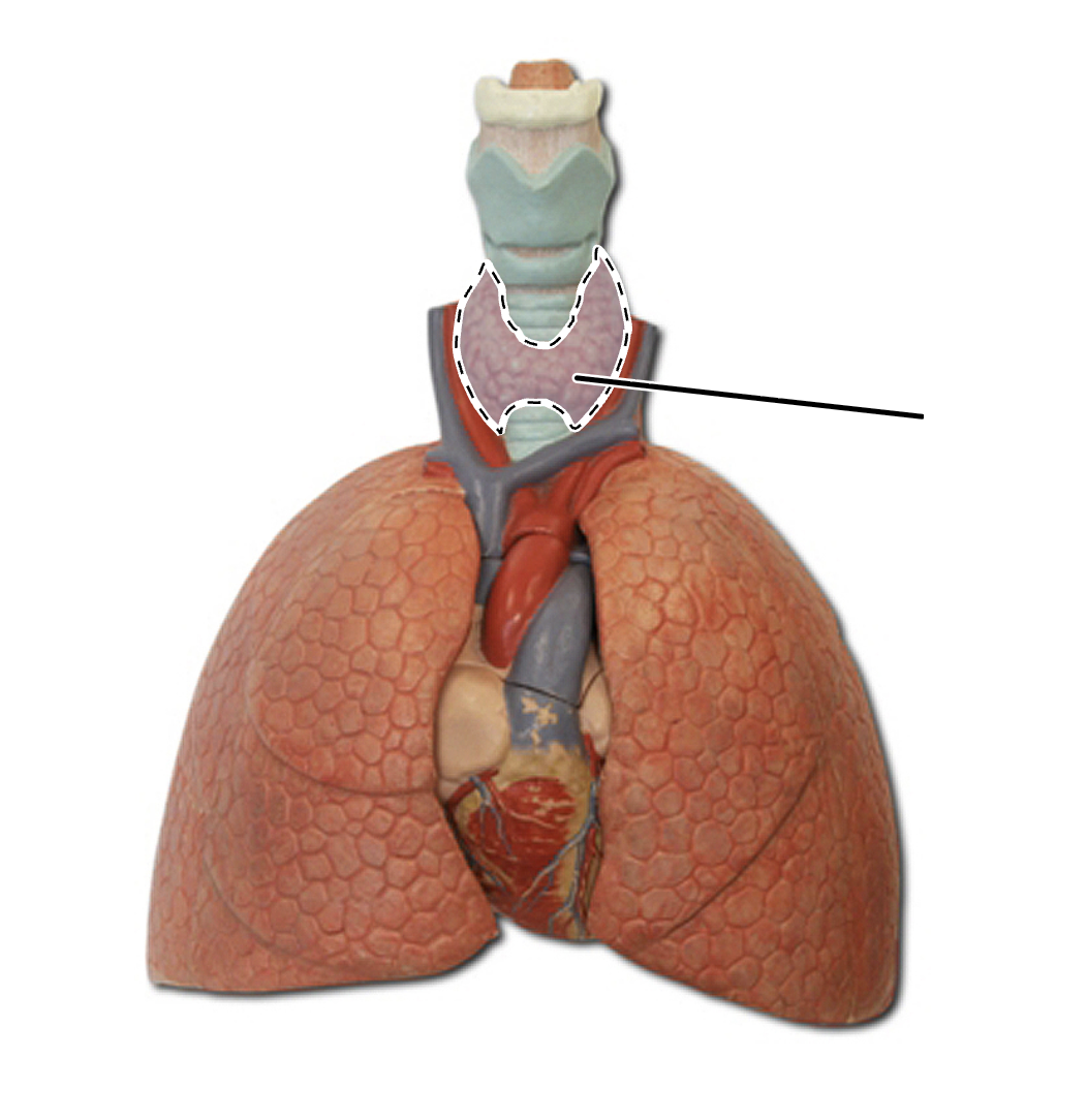 <p>What is this?</p>