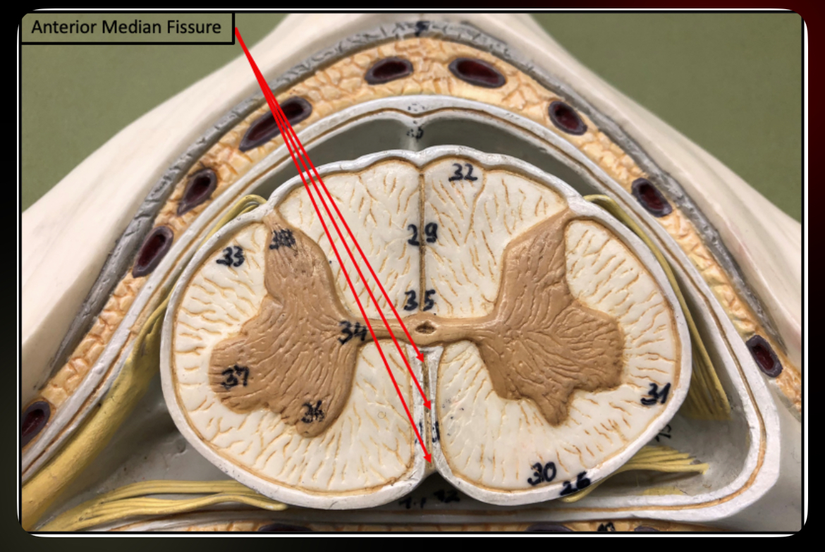 <p>Anterior Median Fissure</p>